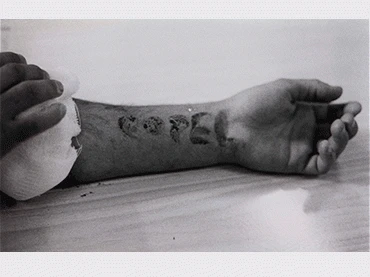 Isabel Esteva, “Colita”. Autolesionados de la COPEL, cárcel La Modelo, Barcelona. Fotografía, 1978