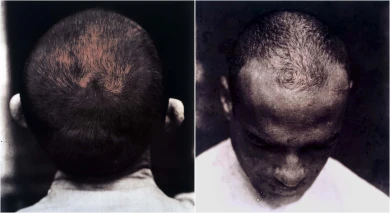 AD00686 montaje digital